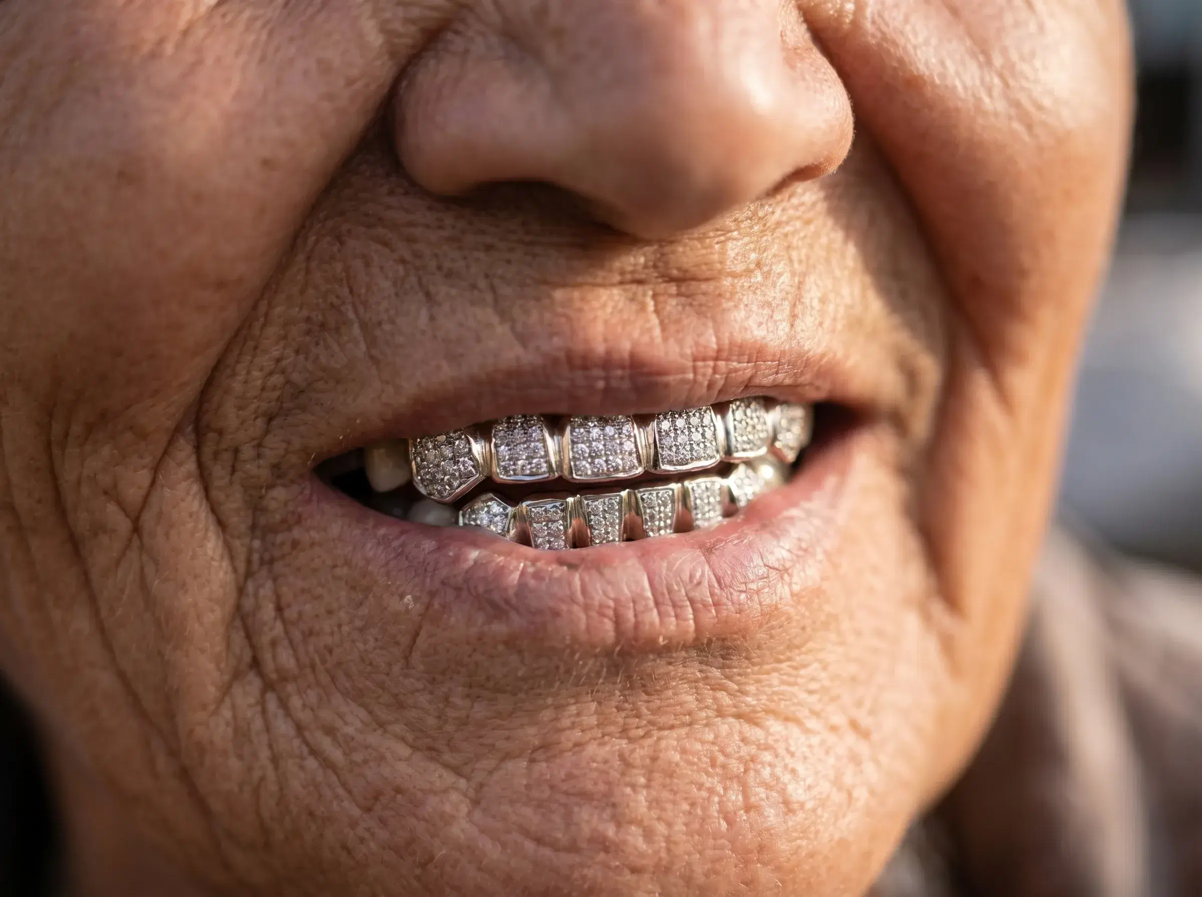 Diamond Smile Close-Up - Gallery 1